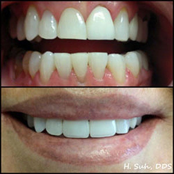 Beaumont Smile Center photo