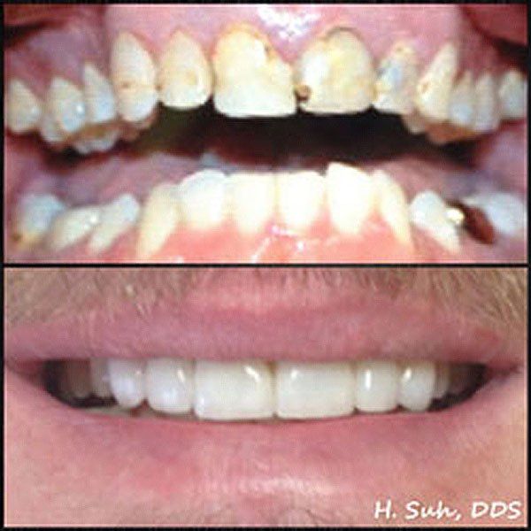 Beaumont Smile Center photo