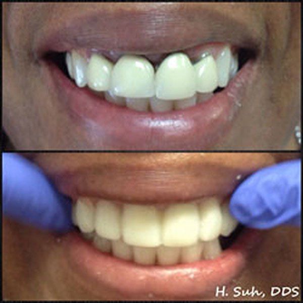 Beaumont Smile Center photo