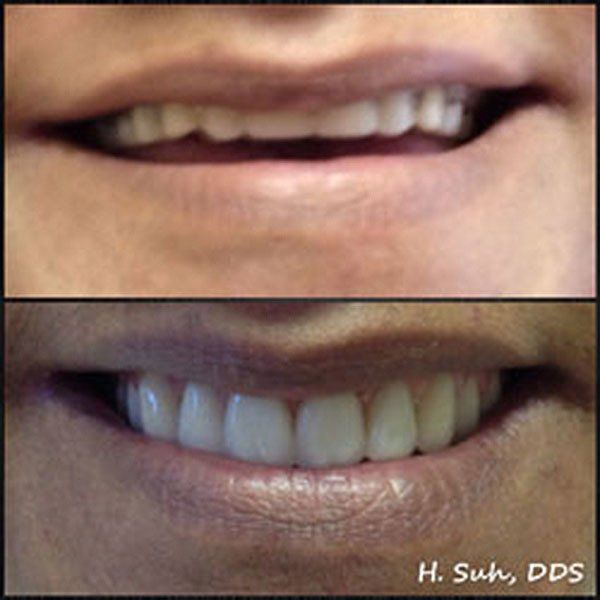 Beaumont Smile Center photo