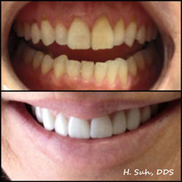 Beaumont Smile Center photo