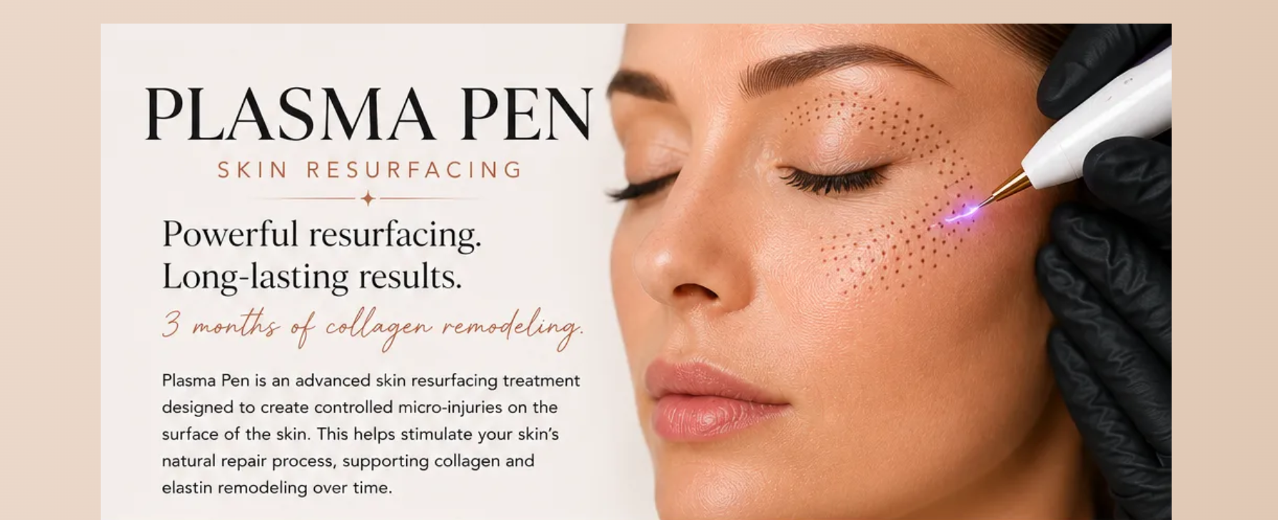 Cosmetic treatment with syringe applied to a woman’s forehead while she lies with eyes closed