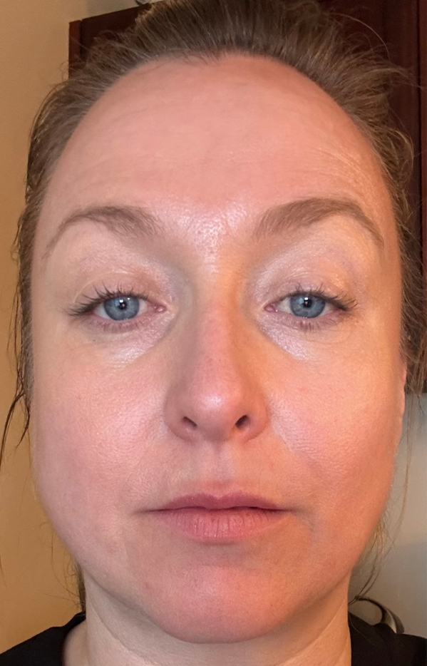 Close-up of a woman’s face with a neutral expression against a dark background