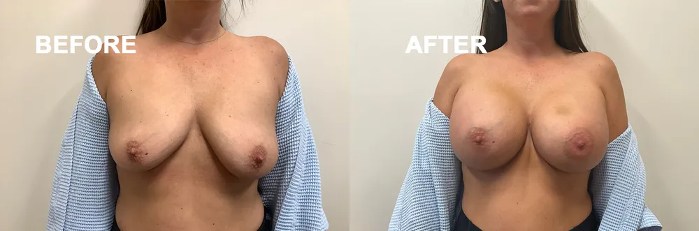 Side-by-side view shows 