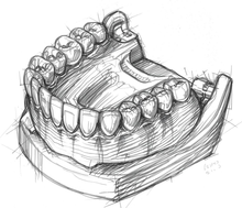Learn More About Removables Removable dentures