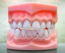 Teeth model