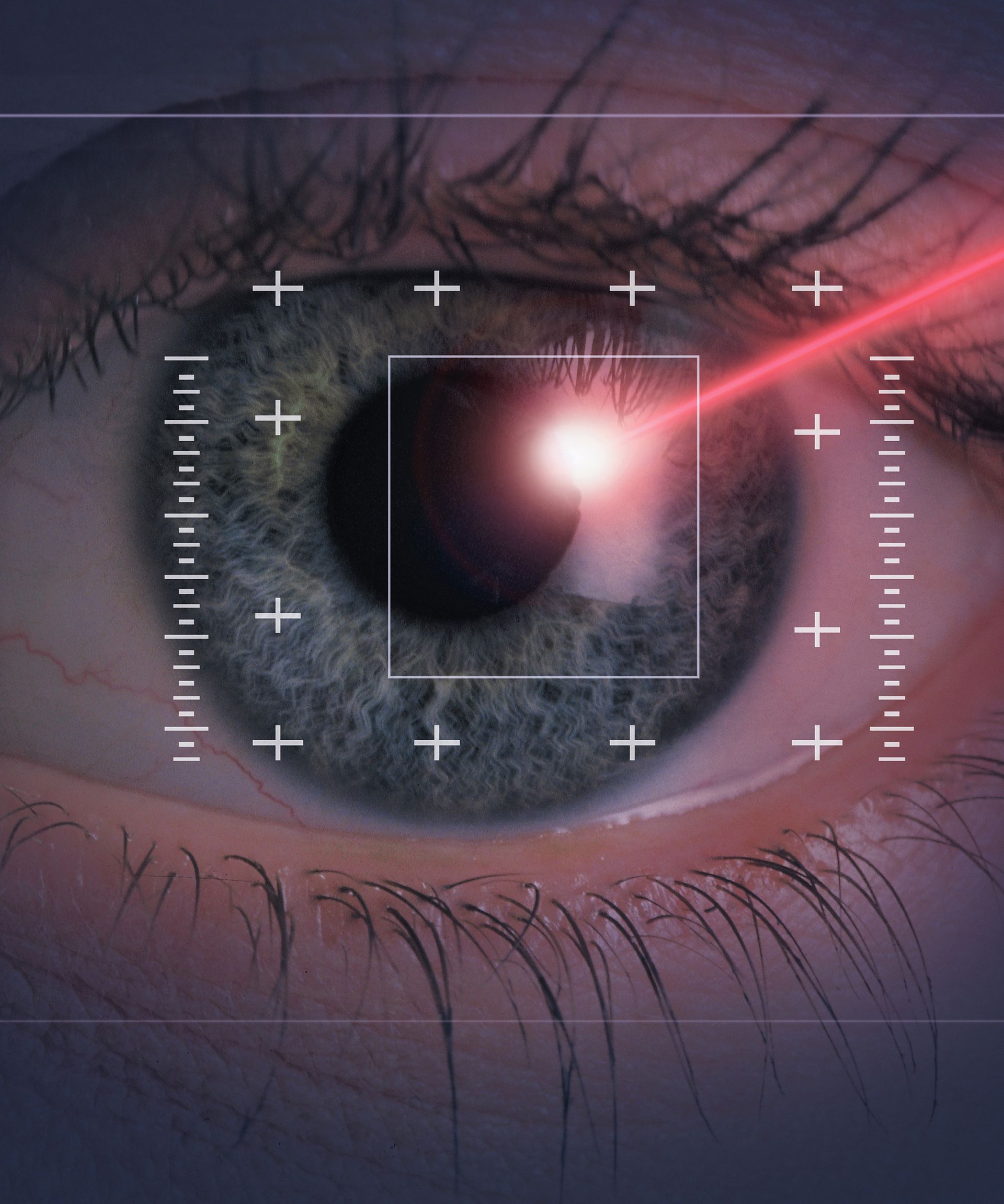 A close up of a person's eye with measurements on it