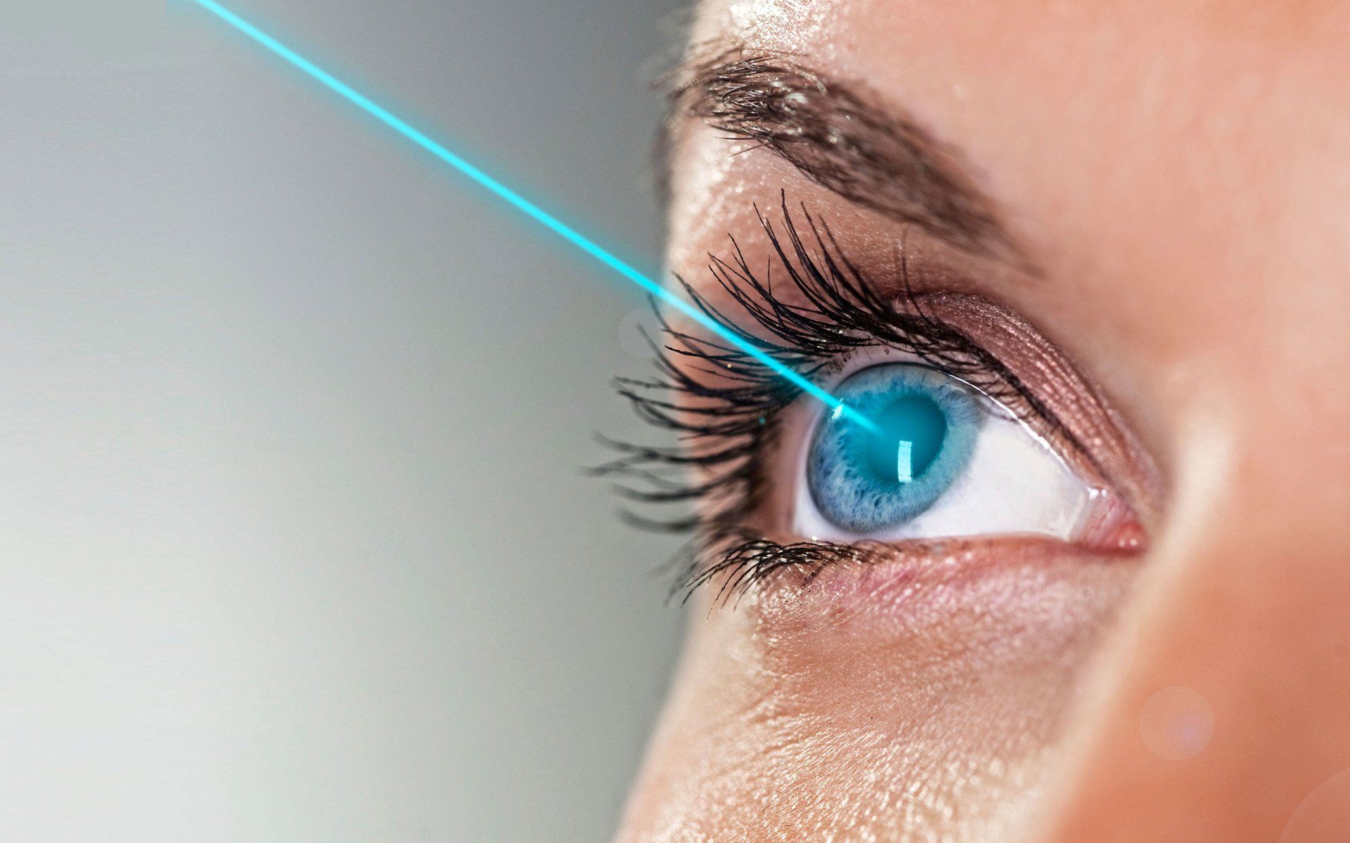 Lasik