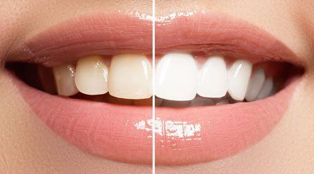 Cosmetic Dentistry