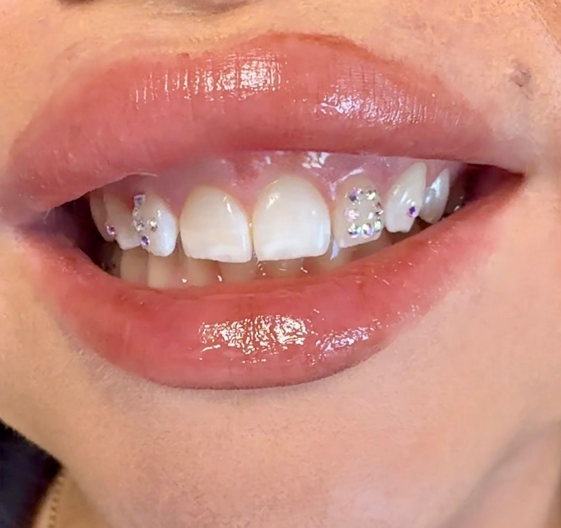 Close-up of a person's smiling mouth with sparkly gems on the teeth and glossy lips.
