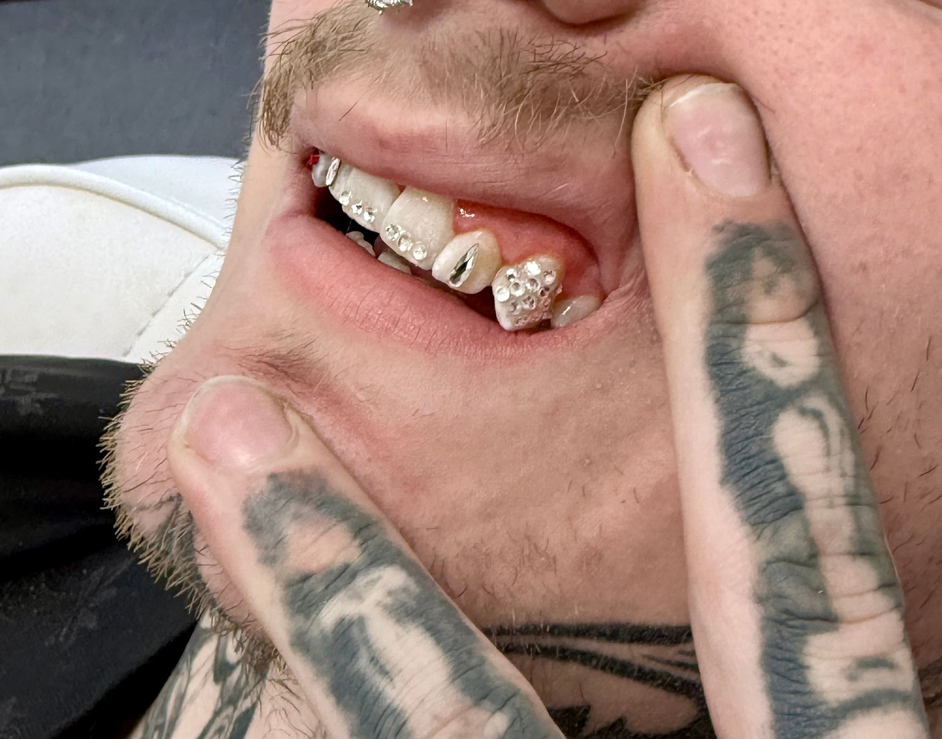 two-fingers-showing-teeth