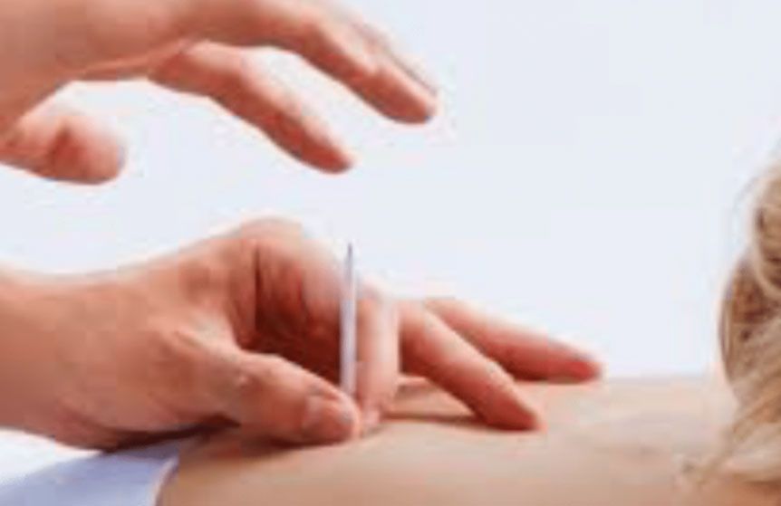 Hands performing acupuncture with a thin needle inserted into skin.