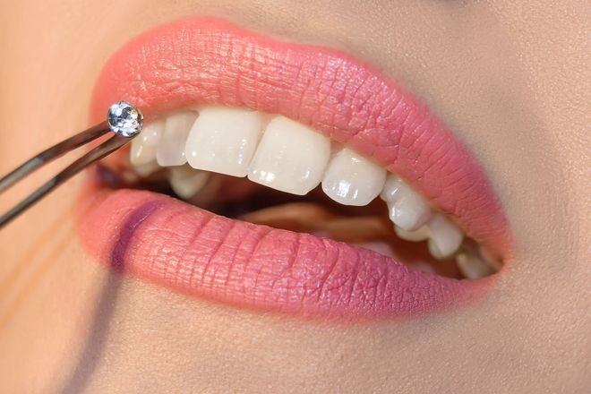 Prima Dental Premier