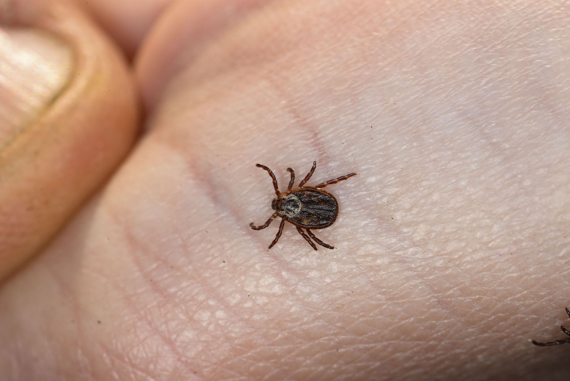 Tick on a person's palm; brown, small arachnid with eight legs.