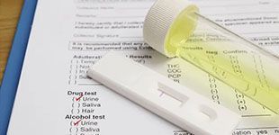 A vial of yellow urine and a white drug test kit resting on a clipboard with a checklist for drug and alcohol testing.