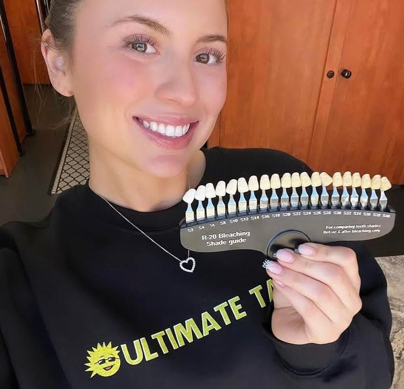 A woman wearing an Ultimate Tanning shirt is holding a tooth color chart