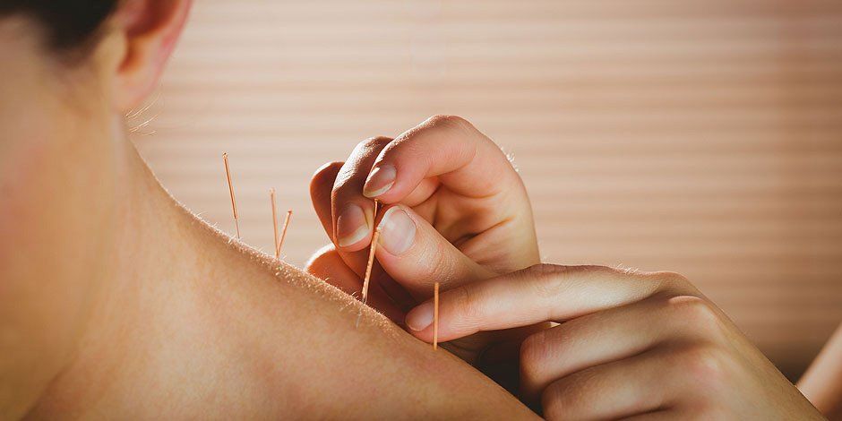 Therapeutic acupuncture