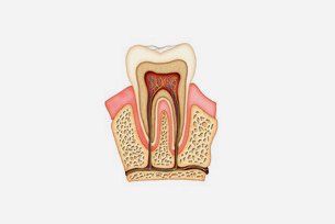 Root canal diagram