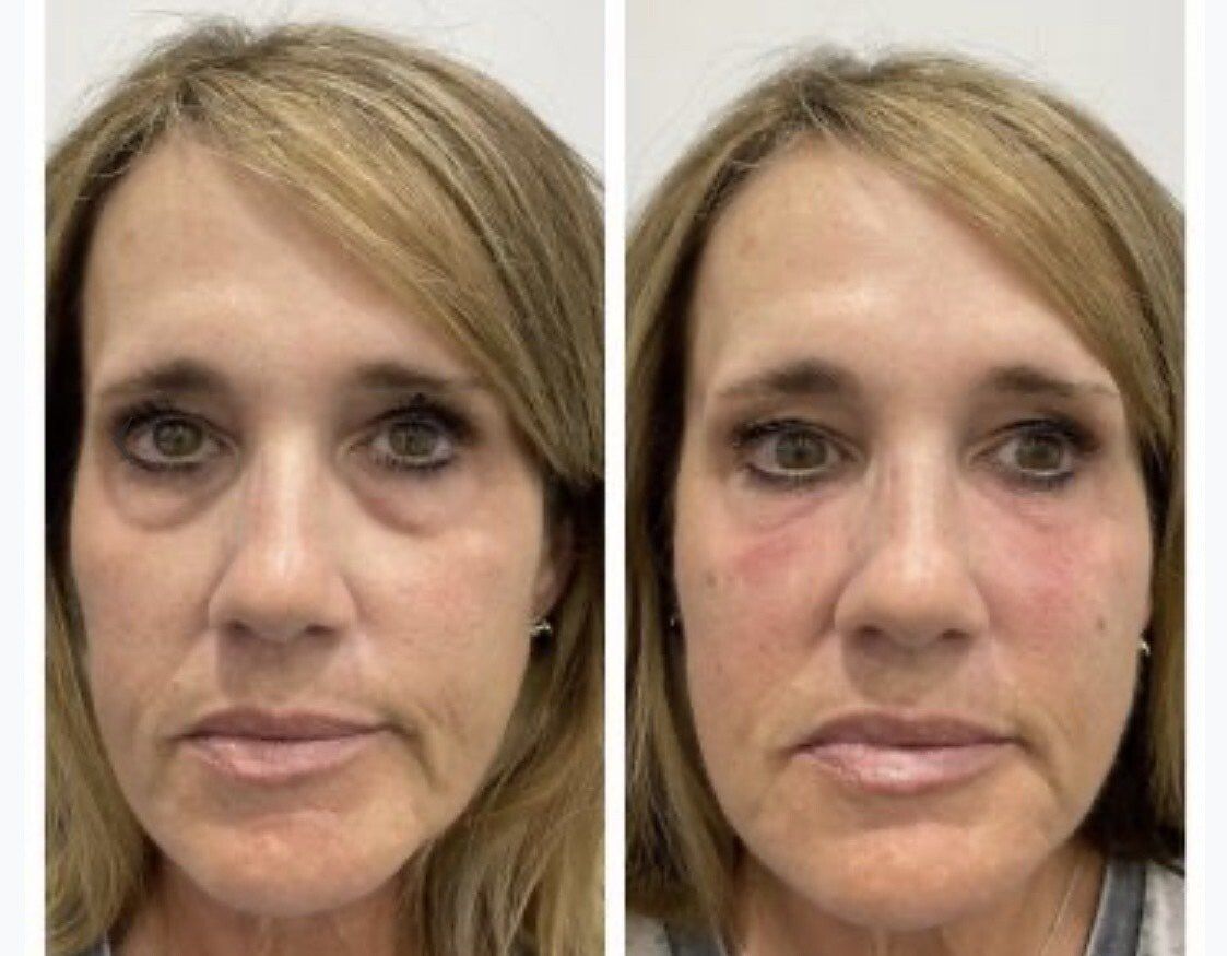 A before and after photo of a woman 's face.