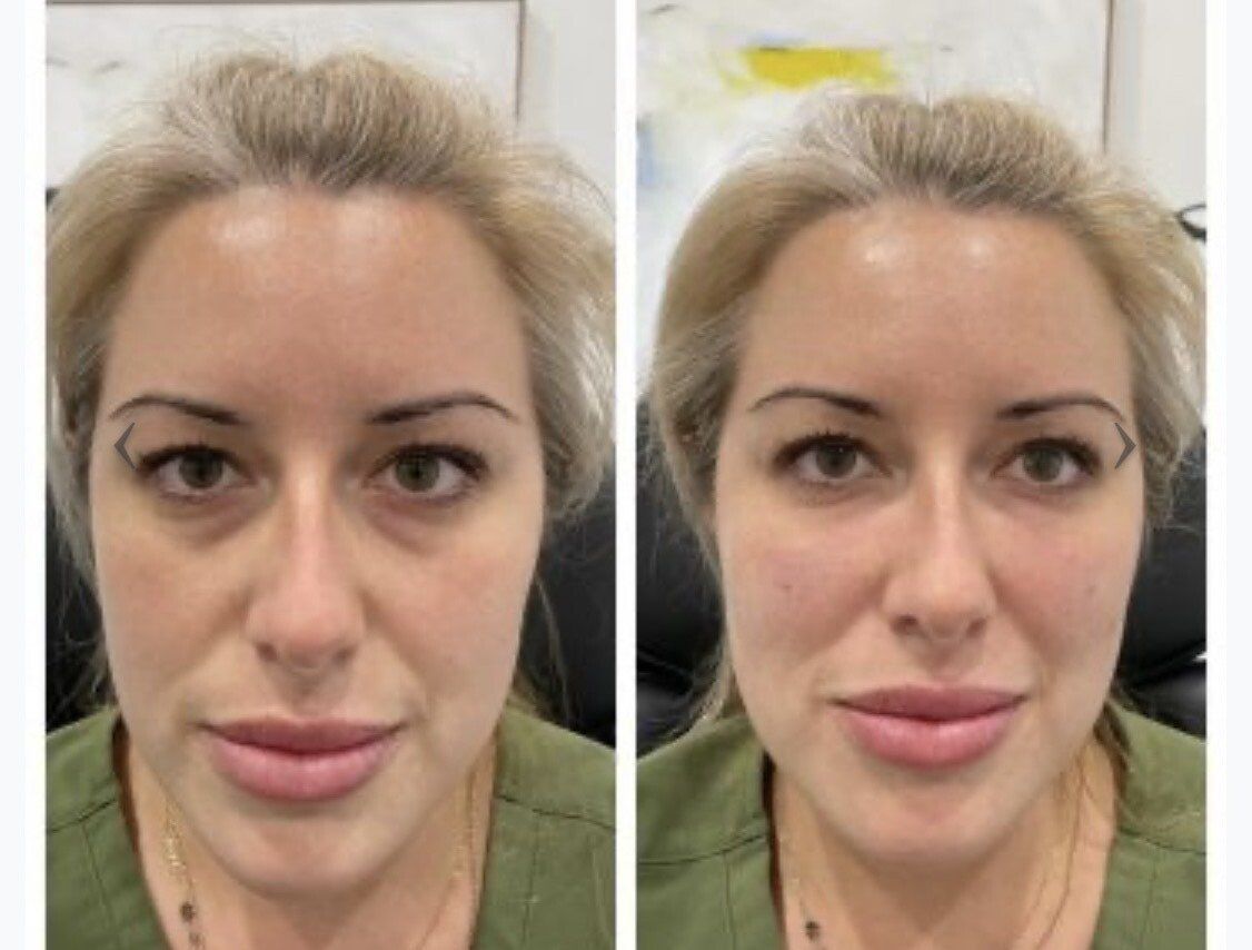 A before and after photo of a woman 's face.