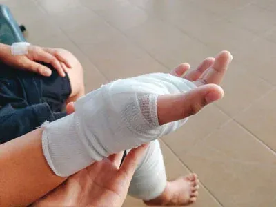 Hand wrapped in white medical bandage.