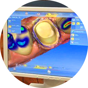 Learn More About Crowns and Dentures Dental technology