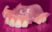 Denture services