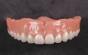 Denture services