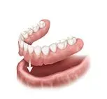 Denture services