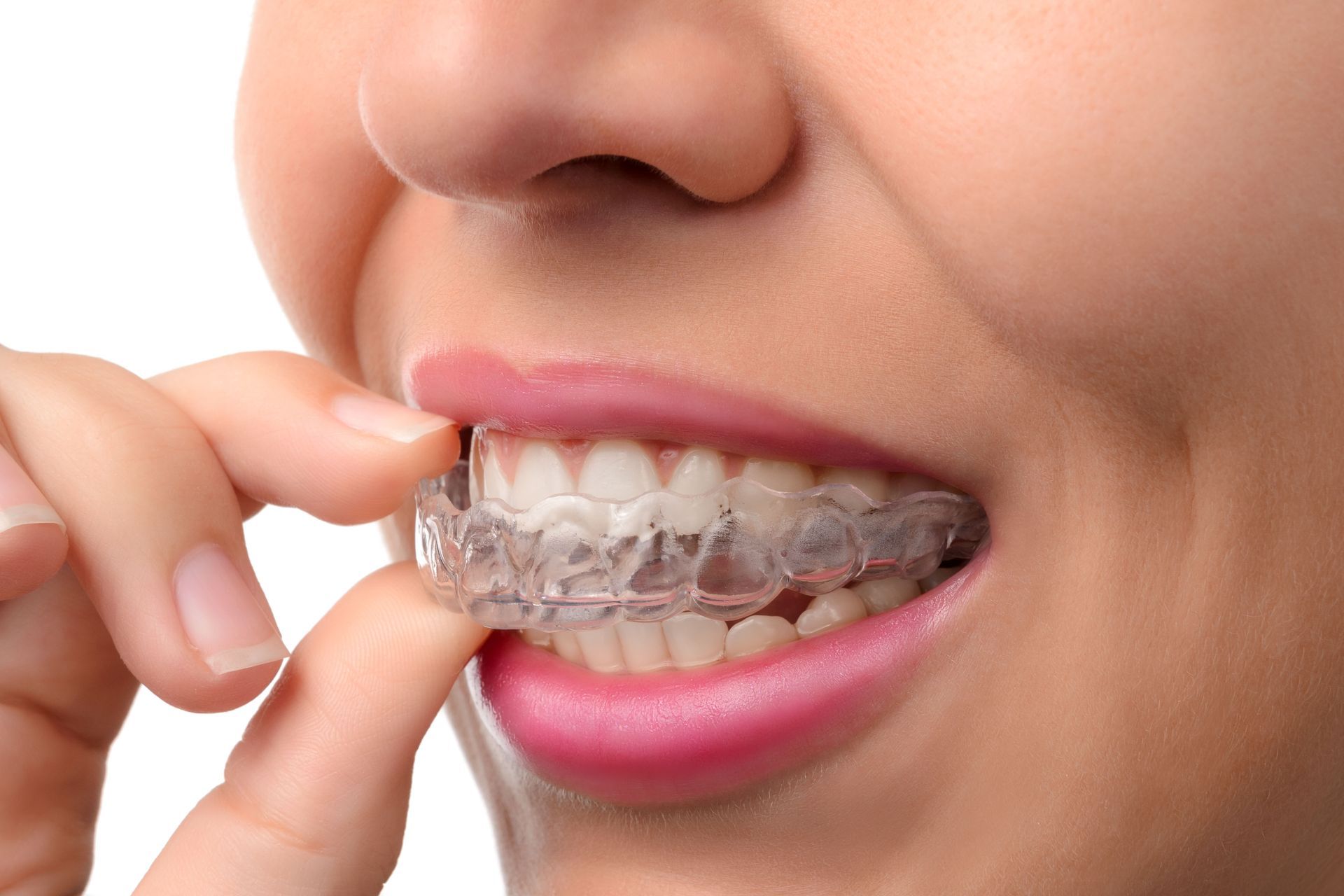 local cosmetic dentists