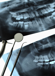 dental xray