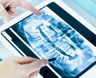 Learn More About General Dentistry women under dental examination