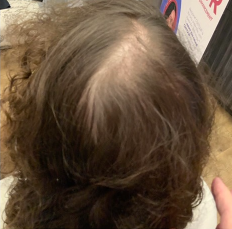 Dark hair before growth