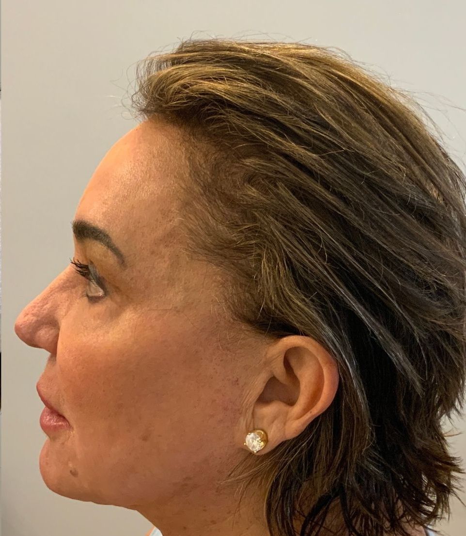 Profile view of a woman with short, layered brown hair, fair skin, and a small pearl earring. She looks off to the side.