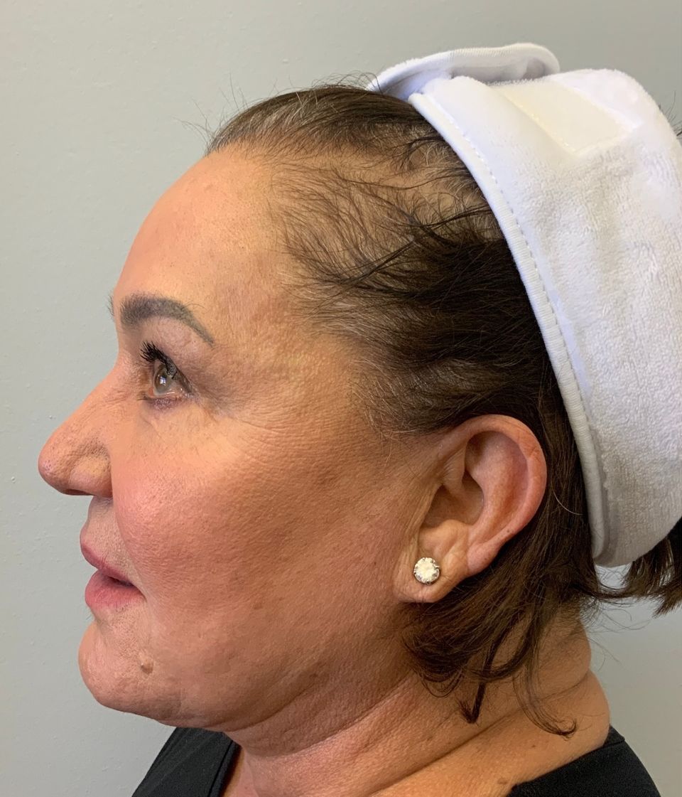 Profile view of a woman with a white headband. She has fair skin, is looking slightly left, and has a neutral expression.