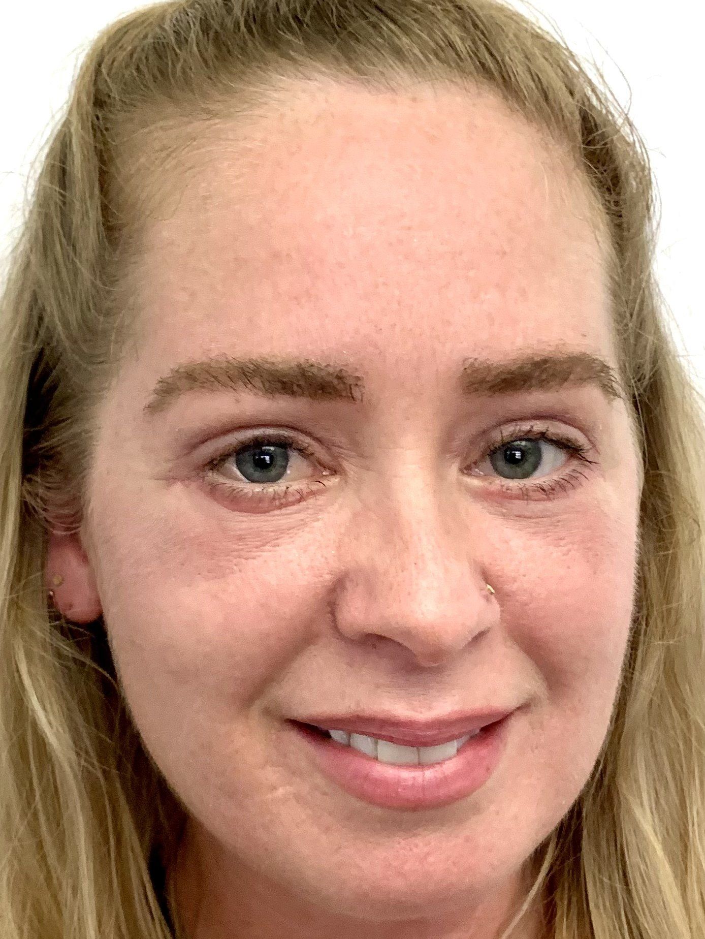 eyebrow growth after