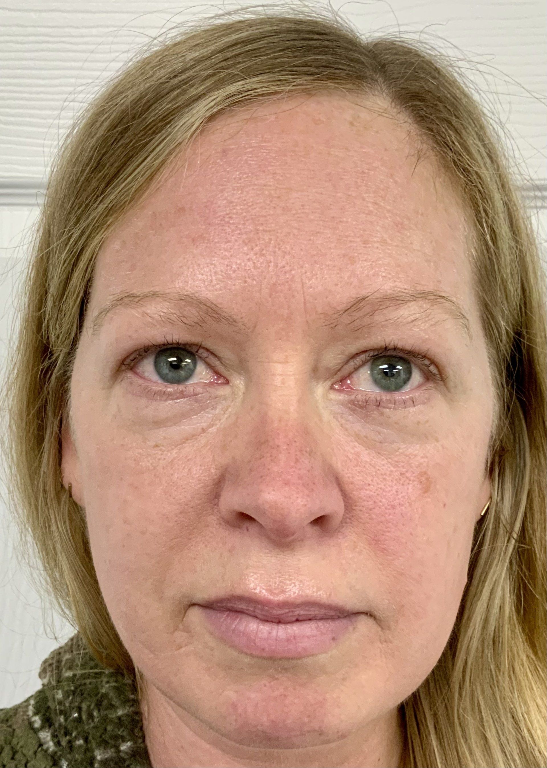 eyebrow growth before