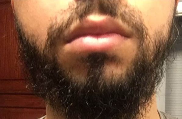 beard growth after
