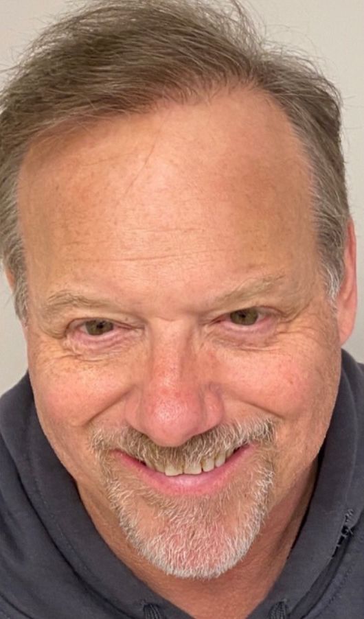 Regency Hair Restoration work