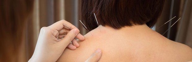 Treated with Acupuncture