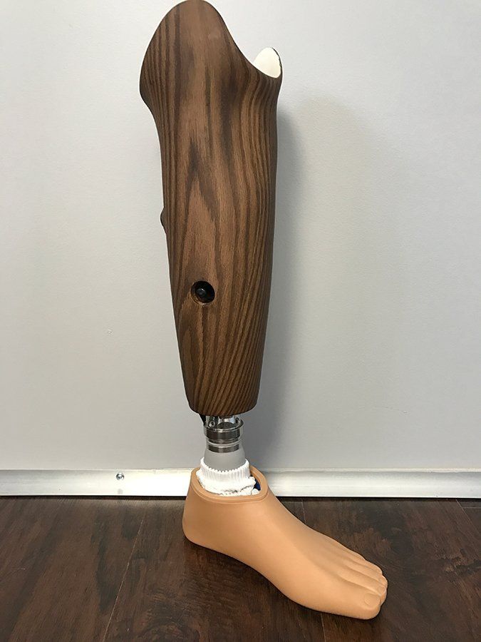 Prosthetic leg