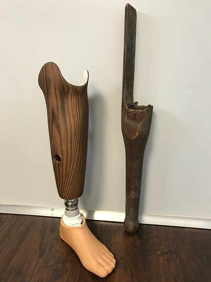 Prosthetic leg