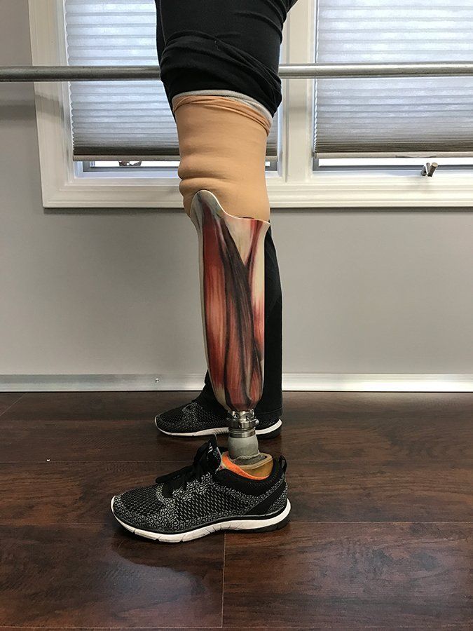 Prosthetic leg