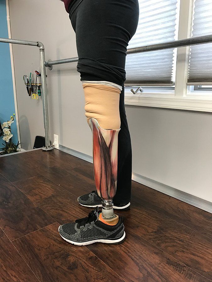 Prosthetic leg