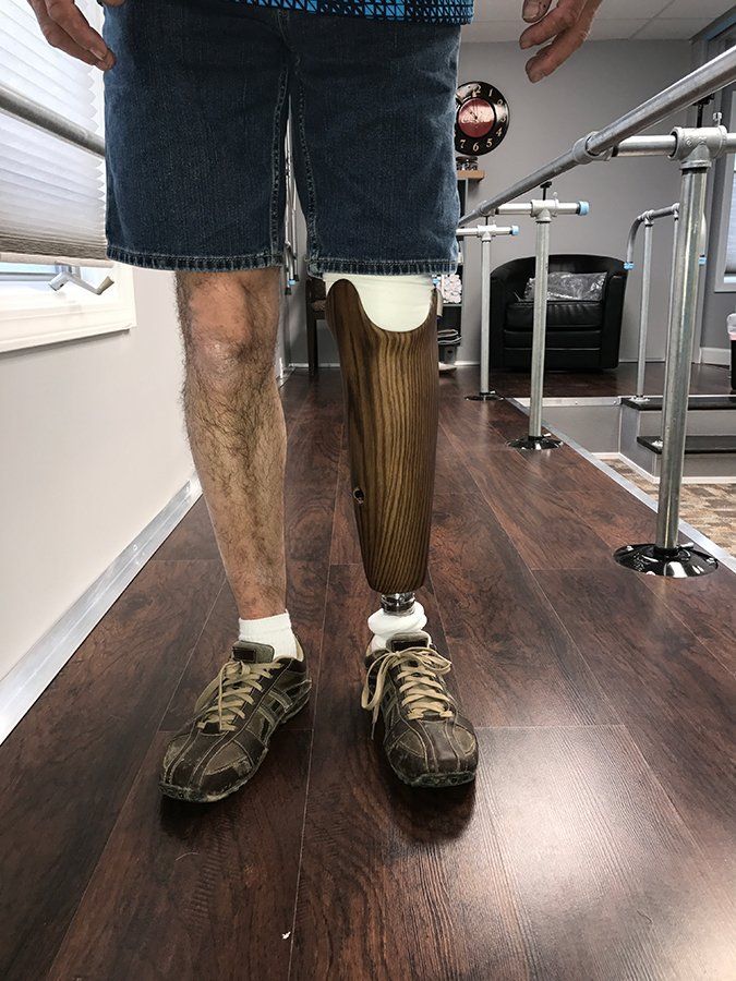 Prosthetic leg