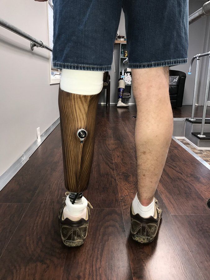 Prosthetic leg