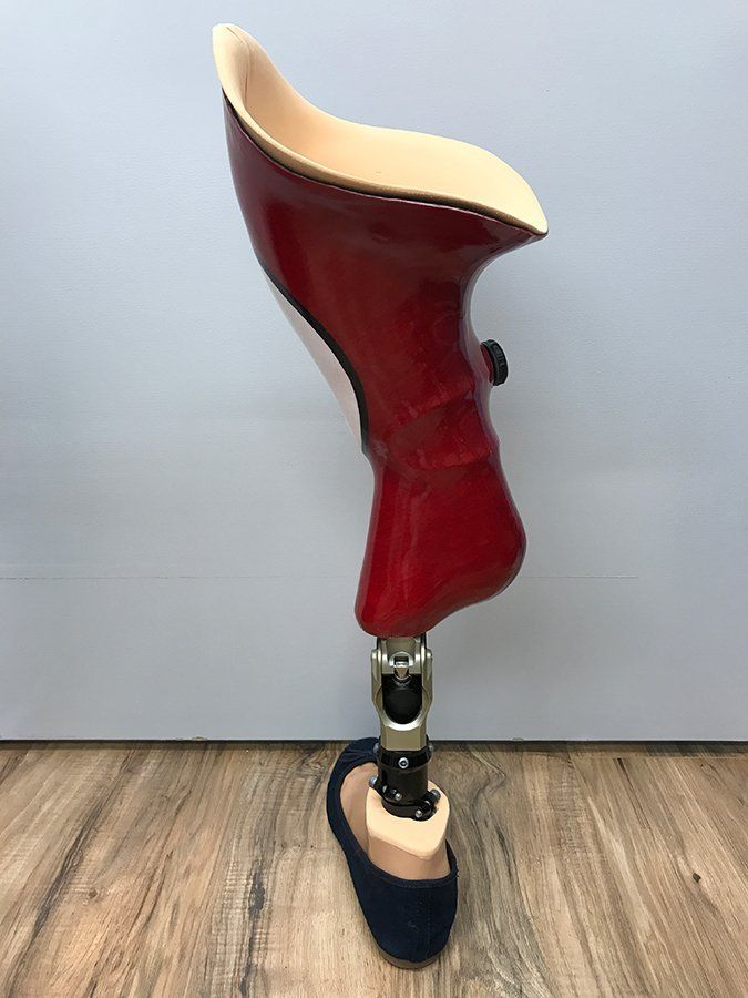Prosthetic leg