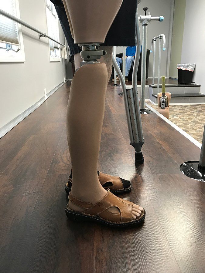 Prosthetic leg