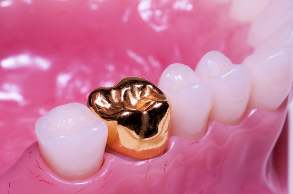 Prima Dental Premier