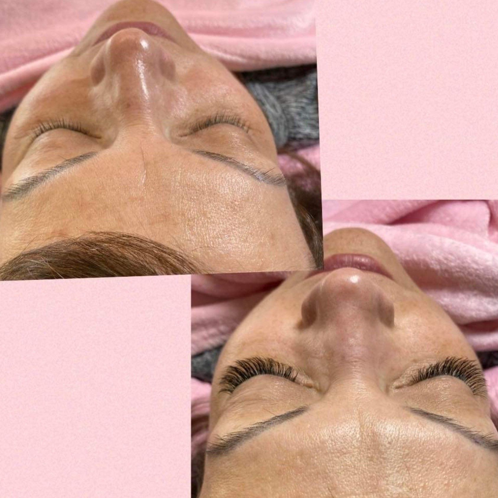 before and after photos of lash extension
